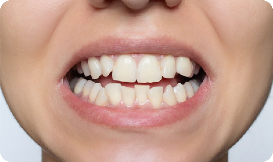orthodontics