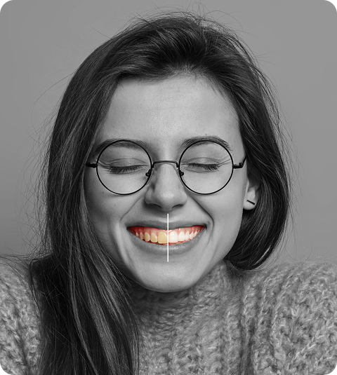 whitening