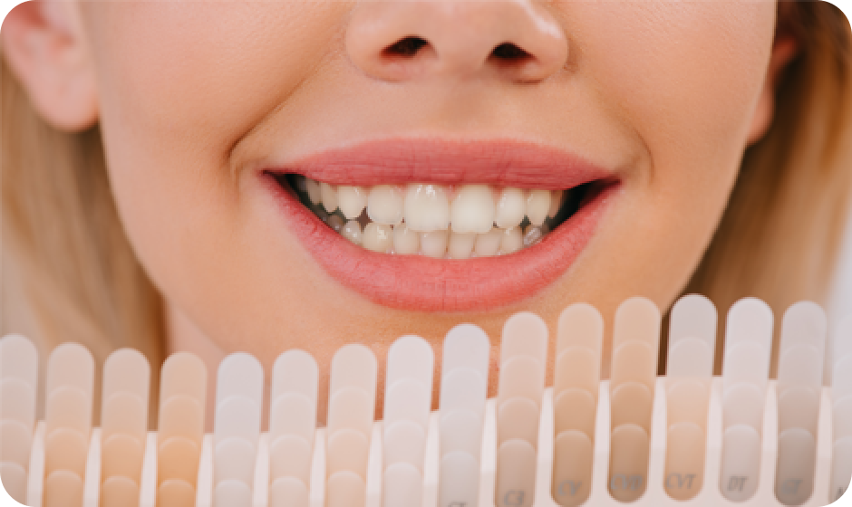 whitening